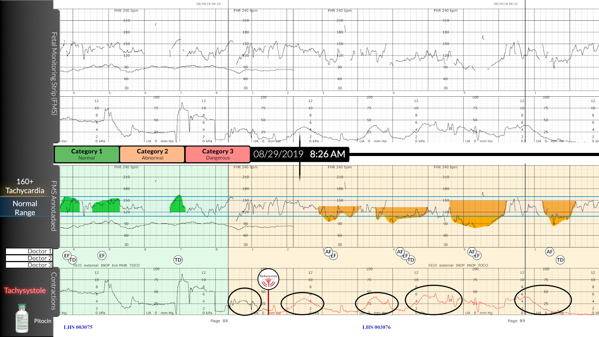Comparative Chart