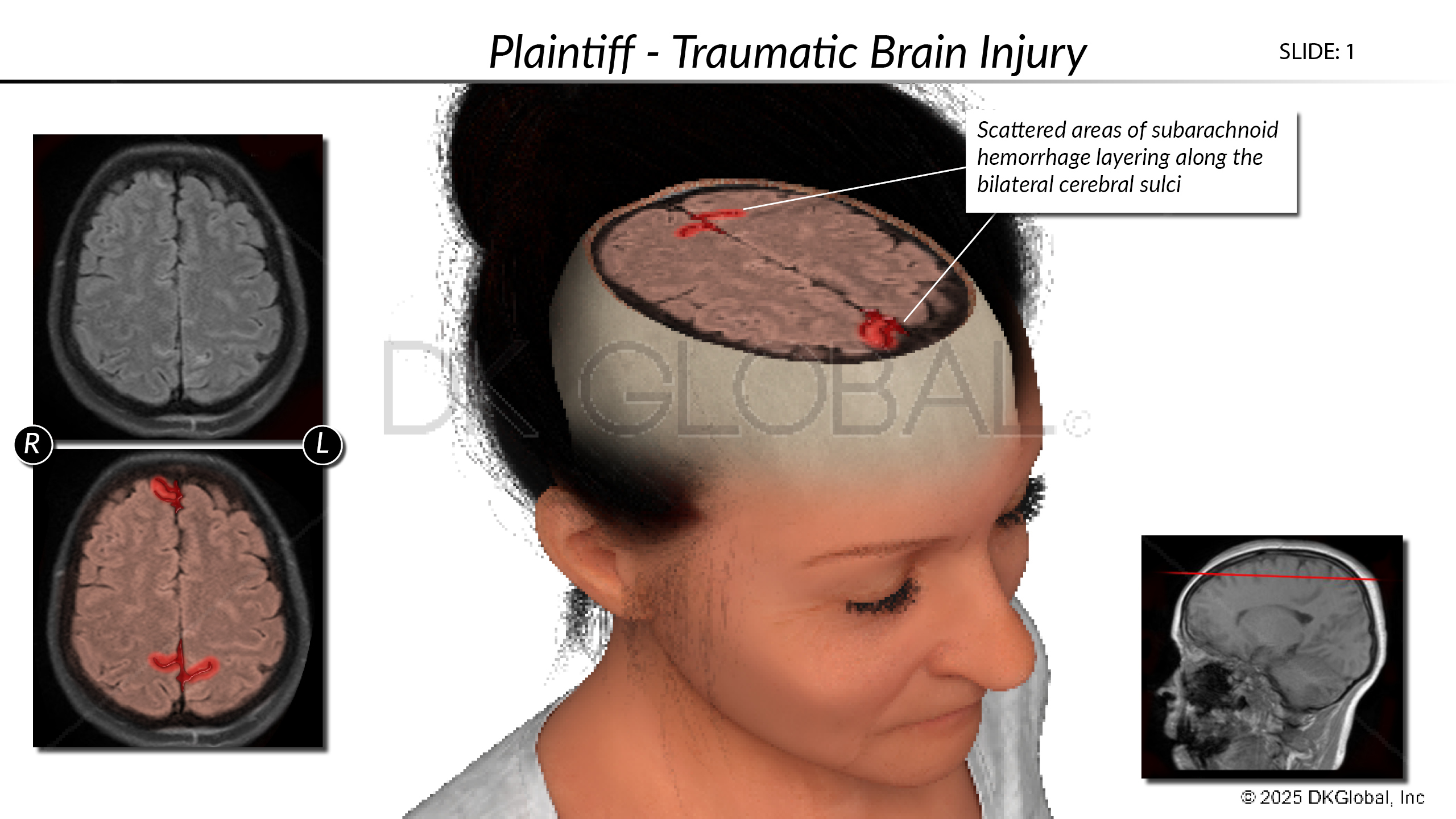 Anatomical Demonstrative