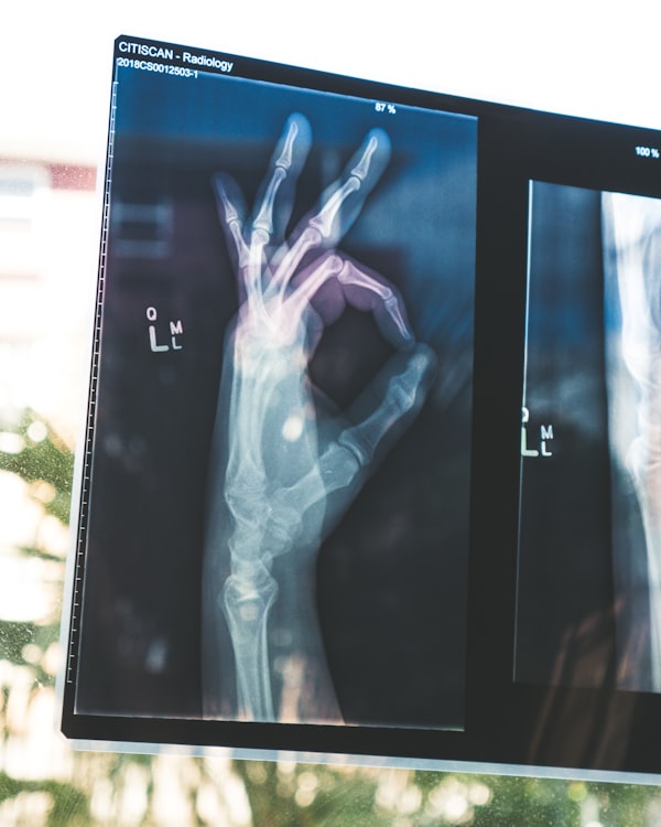 Injury Diagram
